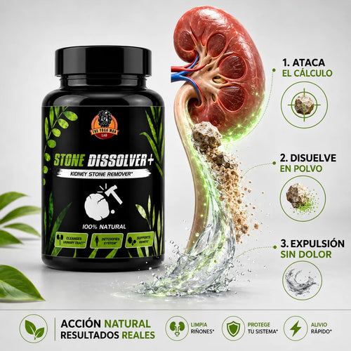Stone Dissolver + 🌿 Disuelve cálculos renales de forma natural